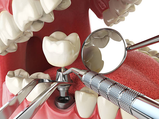 Best Urgent Care for Lost Fillings or Crowns in Brownsville, TN